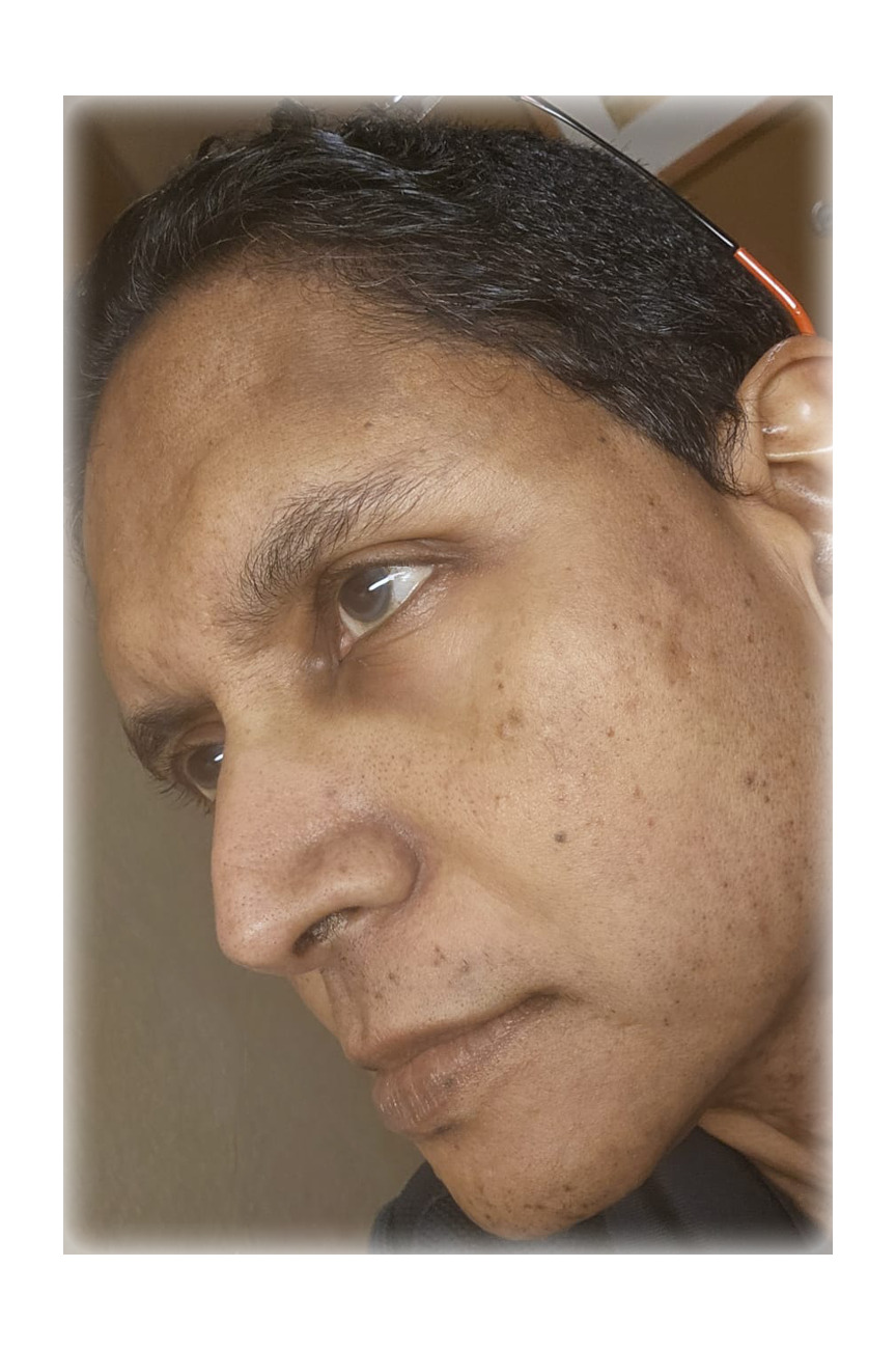 D Kumar MD